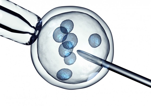 Mikroakışkan Sperm Ayıklama Çipleri