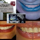 Dentart Diş Kliniği