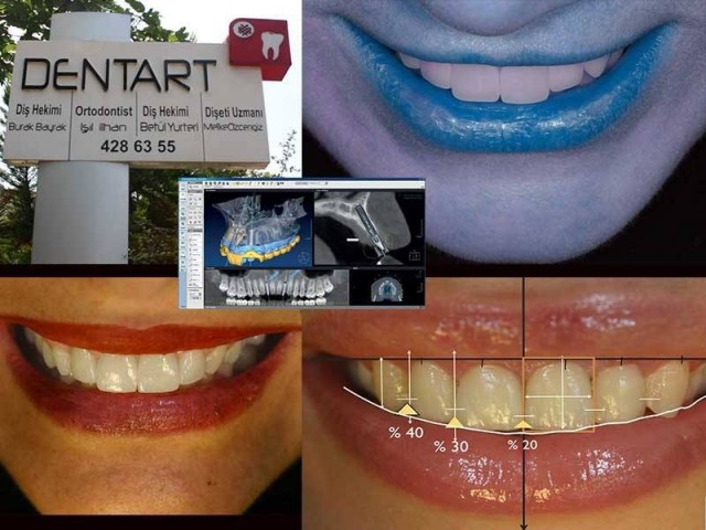 Dentart Diş Kliniği