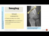 Fracture of Necessity - Lateral Condyle Fracture –In Child