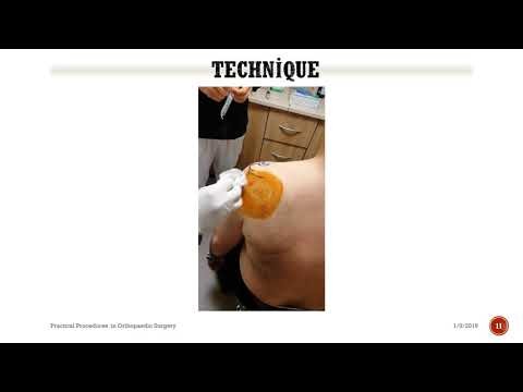 Subacromial injection technique  (With actual didactic video )